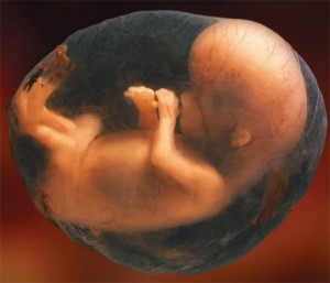 Fetus_amniotic_sac